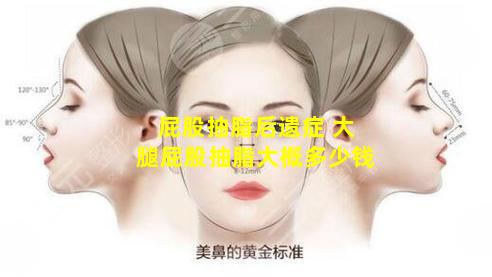 屁股抽脂后遗症 大腿屁股抽脂大概多少钱